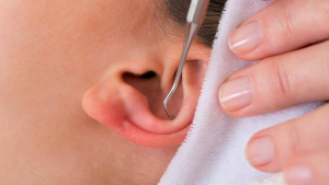 Comprehensive Guide to Treating Blackheads in Ears Blackheads under the ears can be a Clean problem but don't worry With our easy guide you will learn how to treat and Clean them effectively. Here is everything you need to know.