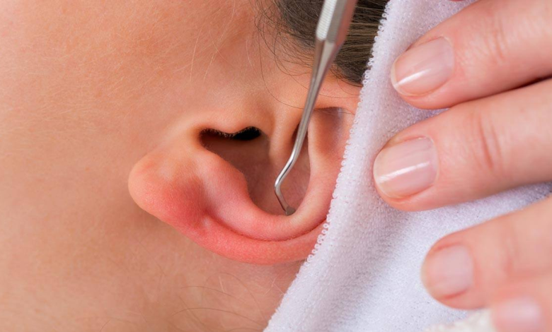 Comprehensive Guide to Treating Blackheads in Ears Blackheads under the ears can be a Clean problem but don't worry With our easy guide you will learn how to treat and Clean them effectively. Here is everything you need to know.